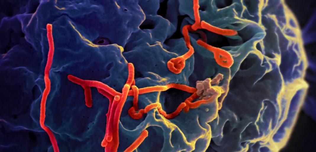 Brésil. Deux hommes présentant des symptômes d’Ebola ont été placés en isolement. Brésil. Deux hommes présentant des symptômes d’Ebola ont été placés en isolement.